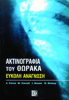 Ακτινογραφία του θώρακα