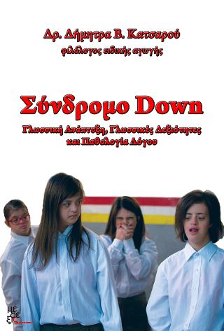 Σύνδρομο Down