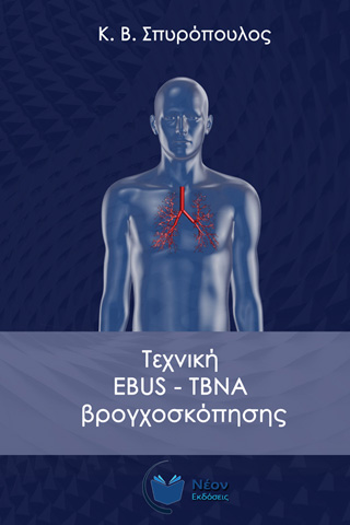 Τεχνική EBUS-TBNA βρογχοσκόπησης